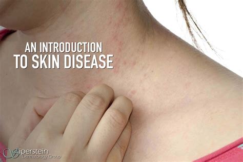 Applying Medical Skin Disease Terminology To The Common Skin Rash