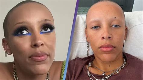 Doja Cat was ‘disturbed’ by fans’ reactions to her shaving her hair off