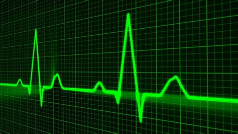 Delta Waves ECG – Understating The Delta Waves Interpretations