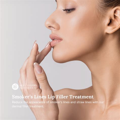 Fillers for Smoker’s Lines – Skin & Derm Theory Aesthetics