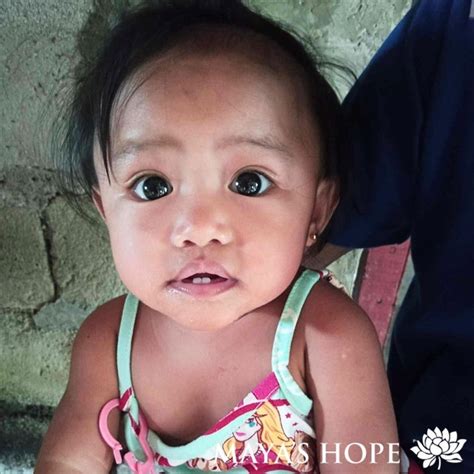 Maya's Hope: Surgery for a 9-month-old girl born with Spina Bifida and Club Foot (PH) | Maya's ...