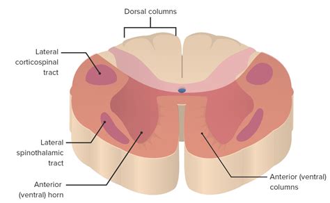 Anterior Cord Syndrome | Concise Medical Knowledge