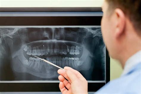 How to Get a Panoramic Dental X-Ray, Costs & Procedure