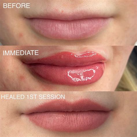 Permanent Makeup for Lips - Everything You Need to Know