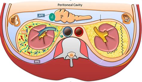 Acute conditions affecting the perinephric space: imaging anatomy ...