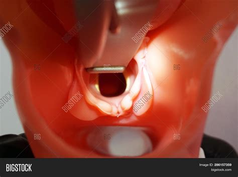 Intubation Tube Image & Photo (Free Trial) | Bigstock