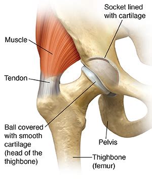 Understanding Hip Replacement | Saint Luke's Health System