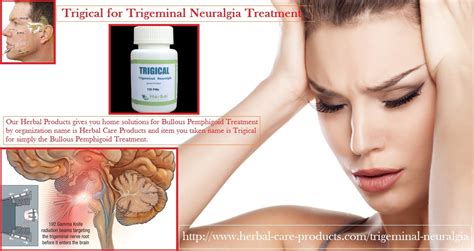 Trigical for Trigeminal Neuralgia Treatment, Symptoms And Causes - Herbal Care Products