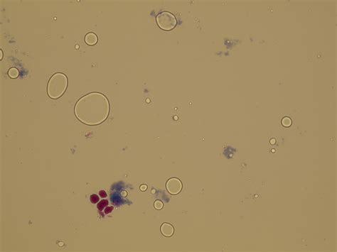 Microscopic Analysis of Urine | Faculty of Medicine, Masaryk University