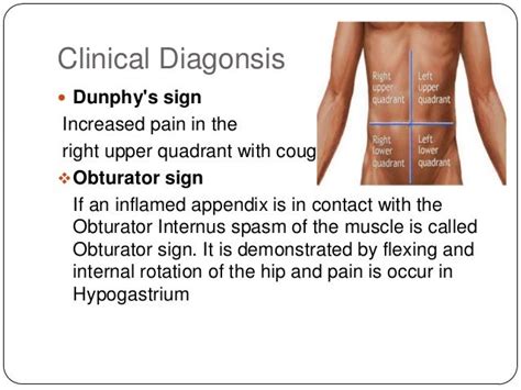 Appendicitis