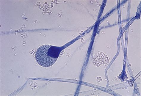 File:Mature sporangium of a Mucor sp. fungus.jpg - Wikimedia Commons