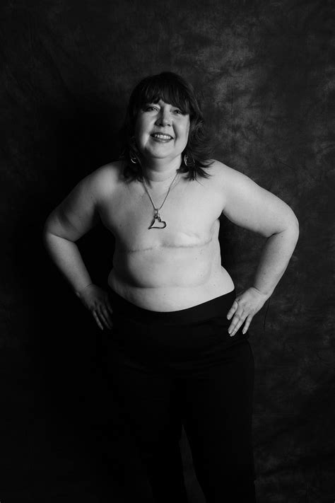 Women Bare Mastectomy Scars In Empowering Photos To Raise Breast Cancer ...