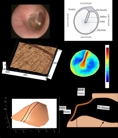 2. Overview of the structure, shape and position of human tympanic... | Download Scientific Diagram