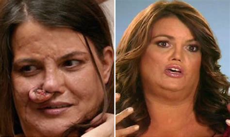 The most astonishing examples of “Botched” plastic surgery ...