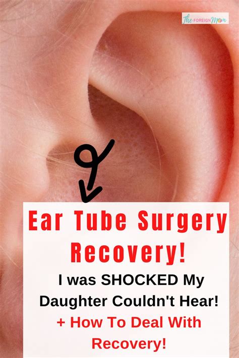 Ear Tube Surgery Recovery! in 2020 | Ear tubes, Surgery recovery, Surgery