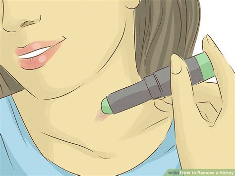 How To Remove Kiss Mark On Neck Fast - Howto Techno