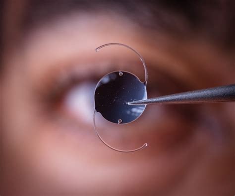 Exploring the Latest Advances in Intraocular Lens for Cataract Surgery