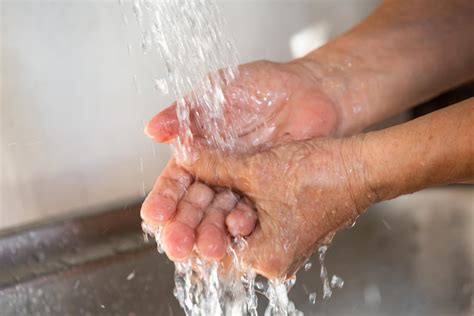 Boiling water burn (scald): Symptoms, treatments, and home remedies