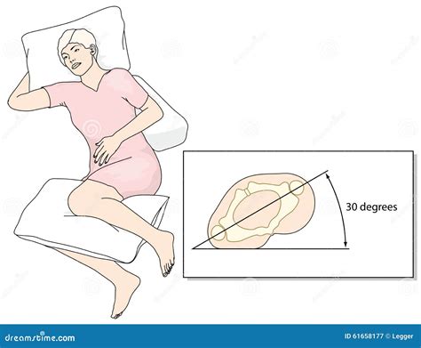 Prevention Of Bed Sores Stock Vector - Image: 61658177