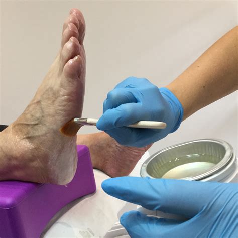 Paraffin Wax Treatments in the Winter – Care For Feet