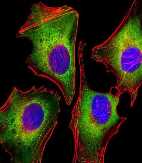 Mouse Monoclonal Antibody to Zap70 (Clone: 1484CT290.68.62)(Discontinued),172677