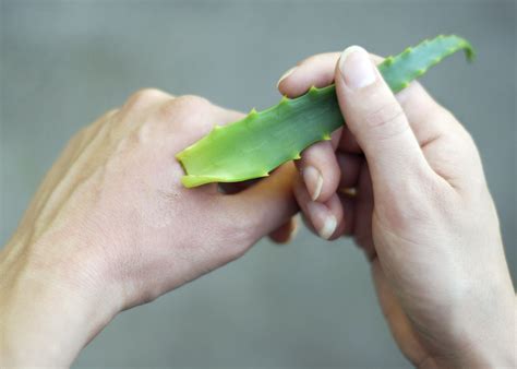 Natural Burn Remedies and Ointments