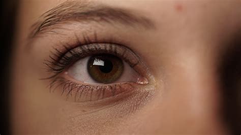 What Causes Dark Circles Around The Eyes