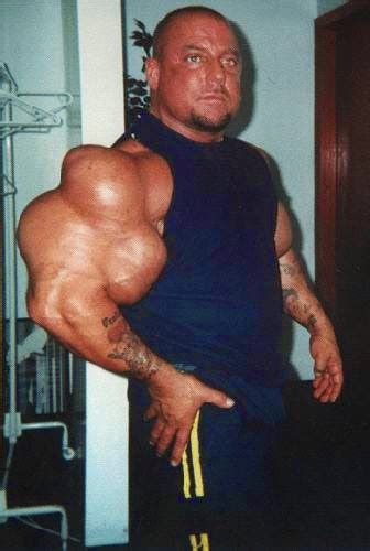 Synthol Freaks of the World | Bodybuilding and Fitness Zone