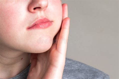 CHEEK SWOLLEN : CAUSES , SYMPTOMS , TREATMENTS