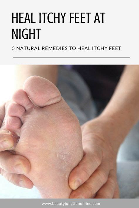 Heal Itchy Feet At Night With 5 Natural Remedies | Foot remedies, Dry feet remedies, Dry skin on ...