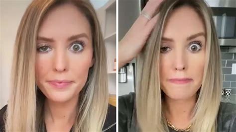 Influencer Reveals Botched Botox Treatment with Shocking Pics