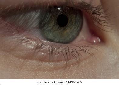 12 Lacrimal caruncle Images, Stock Photos & Vectors | Shutterstock