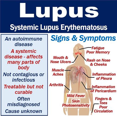 What is lupus? Symptoms, causes, diagnosis, and treatment - MBN Health