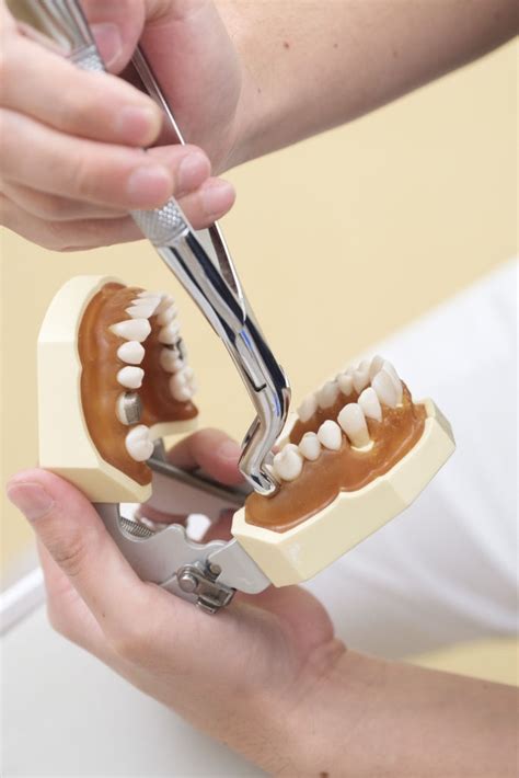 Tooth Removal - Gerrards Cross Dentist