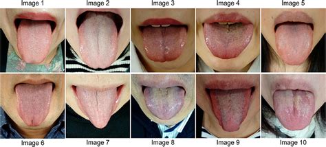 Diagnosis Tongue Problems