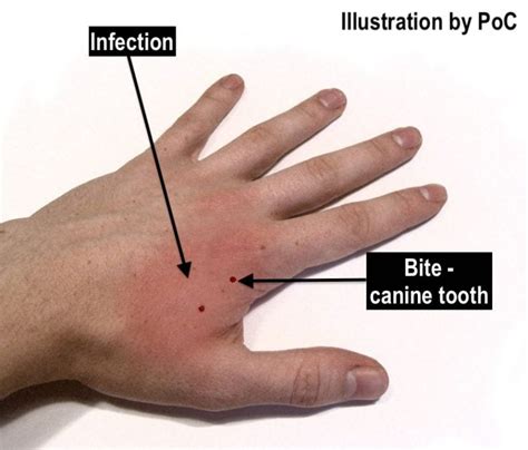 Albums 93+ Pictures Infection Healing Cat Wound Healing Stages Pictures ...