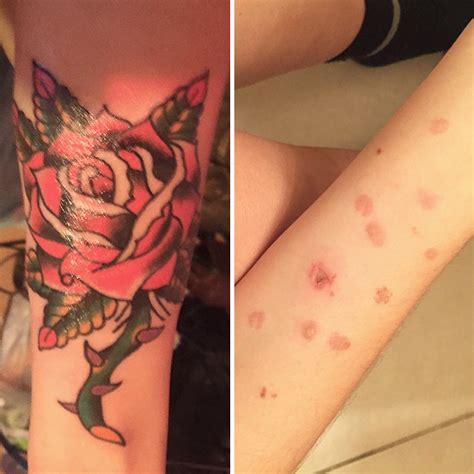 Beautiful Scar-Covering Tattoos | Memolition