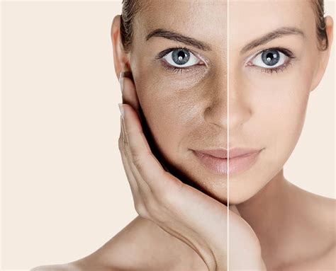 Fine Lines & Wrinkle Treatment - Welona