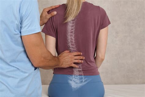 What Can Physical Therapy do For Scoliosis And Where to Take it