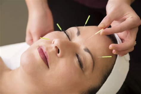 Can You Treat Anxiety and Depression With Acupuncture