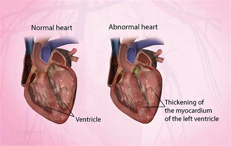 Health Condition : Symptoms, Causes, Treatment and More