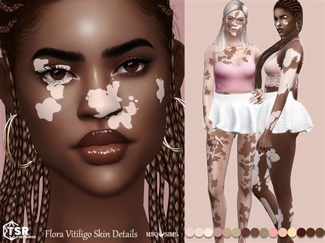 Sims 4 vitiligo skin detail - vsaben