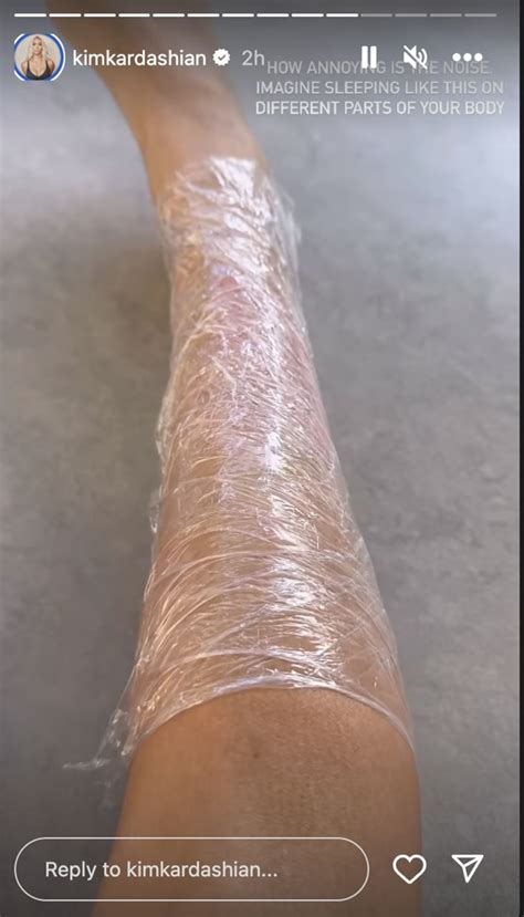 Kim Kardashian Psoriasis Video Shows 'Painful' Flare-Up And Her Hack ...