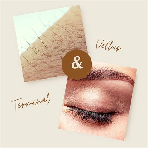 Vellus Hair Vs. Terminal Hair: What Are The Differences?