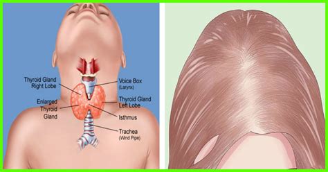 Which Hormones Are Responsible For Boosting Hair Growth And Preventing Hair Fall?