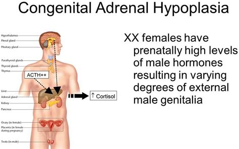 Adrenal hypoplasia causes, symptoms, diagnosis, treatment & prognosis