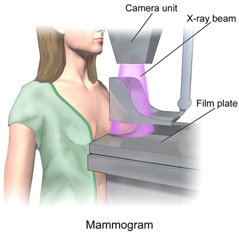 Mammography Images | ADVANCED RADIOLOGIC CERTIFICATIONS