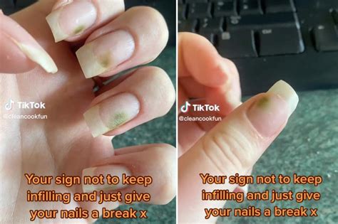 I had a beautiful manicure — until mold grew on my nails