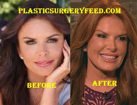 Roma Downey Plastic Surgery - Plastic Surgery Feed