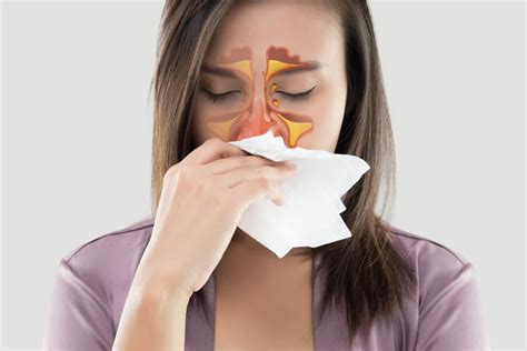 Chronic Sinusitis And Allergies: What To Know | California Sinus